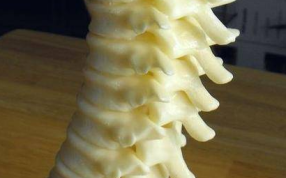 人类椎骨设计模型