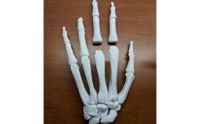3D指骨模型