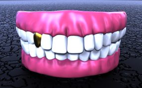 牙齿高模造型